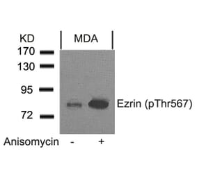 Western blot - Ezrin (Phospho-Thr567) Antibody from Signalway Antibody (11202) - Antibodies.com