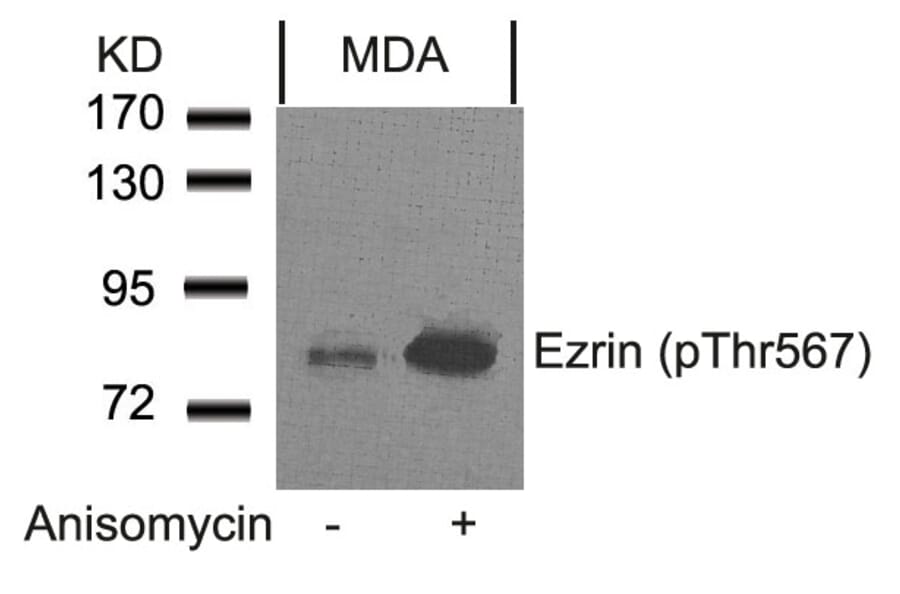 Western blot - Ezrin (Phospho-Thr567) Antibody from Signalway Antibody (11202) - Antibodies.com
