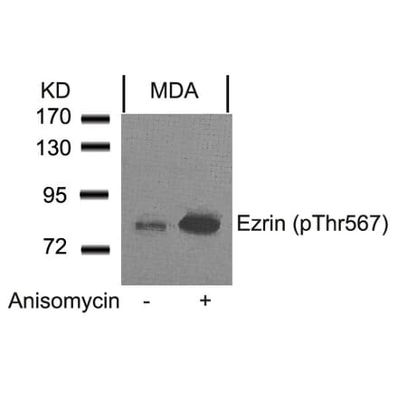 Western blot - Ezrin (Phospho-Thr567) Antibody from Signalway Antibody (11202) - Antibodies.com