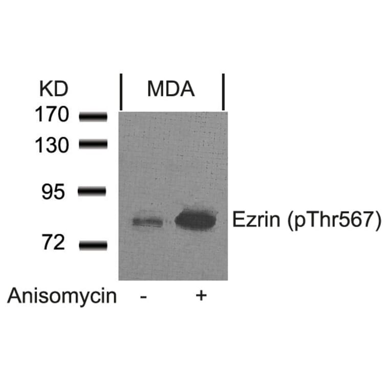 Western blot - Ezrin (Phospho-Thr567) Antibody from Signalway Antibody (11202) - Antibodies.com
