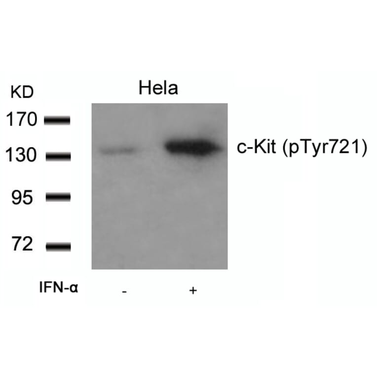 Western blot - c-Kit (Phospho-Tyr721) Antibody from Signalway Antibody (11240) - Antibodies.com