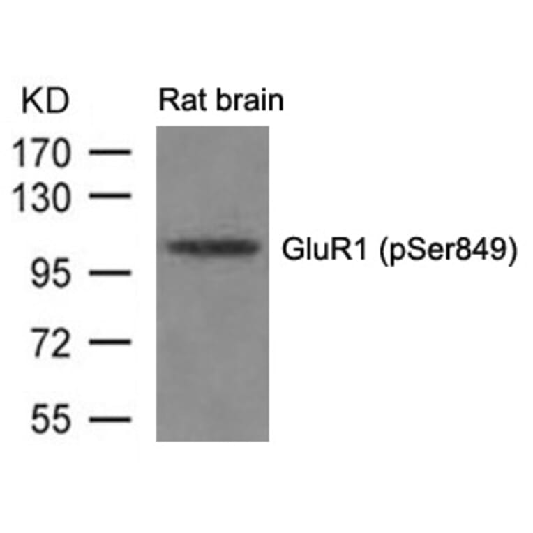 Western blot - GluR1 (phospho-Ser849) Antibody from Signalway Antibody (11261) - Antibodies.com
