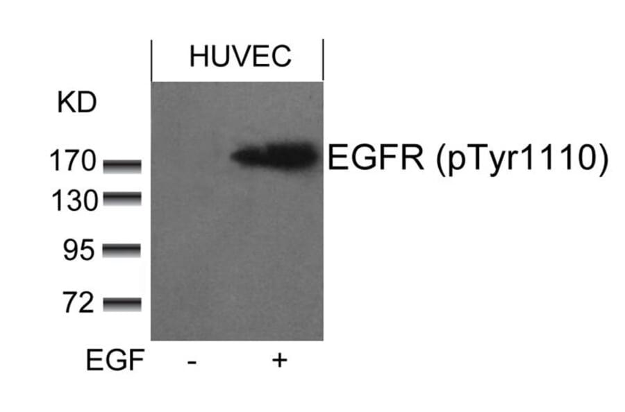 Western blot - EGFR (phospho-Tyr1110) Antibody from Signalway Antibody (11264) - Antibodies.com