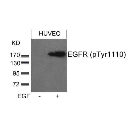 Western blot - EGFR (phospho-Tyr1110) Antibody from Signalway Antibody (11264) - Antibodies.com