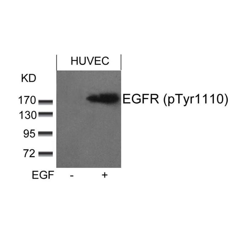 Western blot - EGFR (phospho-Tyr1110) Antibody from Signalway Antibody (11264) - Antibodies.com