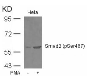 Western blot - Smad2 (Phospho-Ser467) Antibody from Signalway Antibody (11322) - Antibodies.com