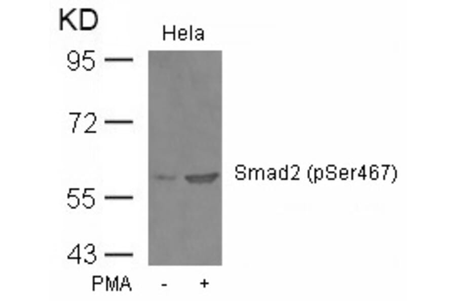 Western blot - Smad2 (Phospho-Ser467) Antibody from Signalway Antibody (11322) - Antibodies.com