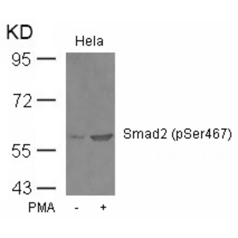 Western blot - Smad2 (Phospho-Ser467) Antibody from Signalway Antibody (11322) - Antibodies.com