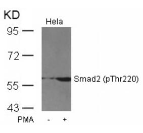 Western blot - Smad2 (Phospho-Thr220) Antibody from Signalway Antibody (11323) - Antibodies.com