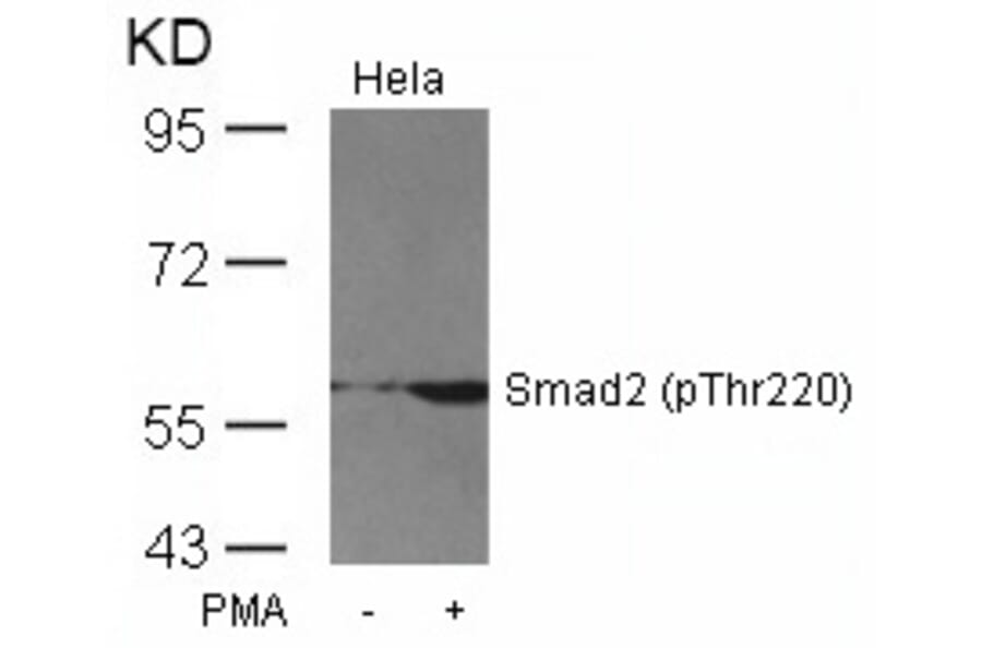 Western blot - Smad2 (Phospho-Thr220) Antibody from Signalway Antibody (11323) - Antibodies.com