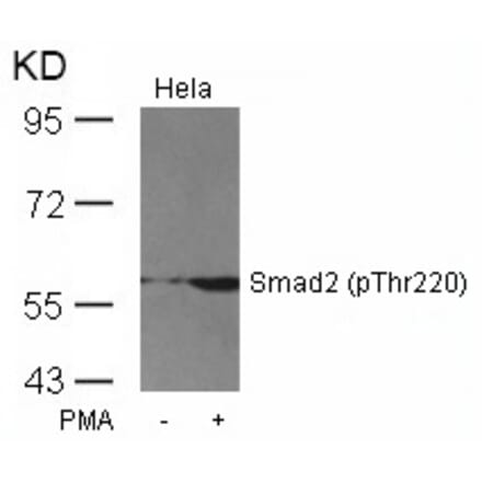Western blot - Smad2 (Phospho-Thr220) Antibody from Signalway Antibody (11323) - Antibodies.com