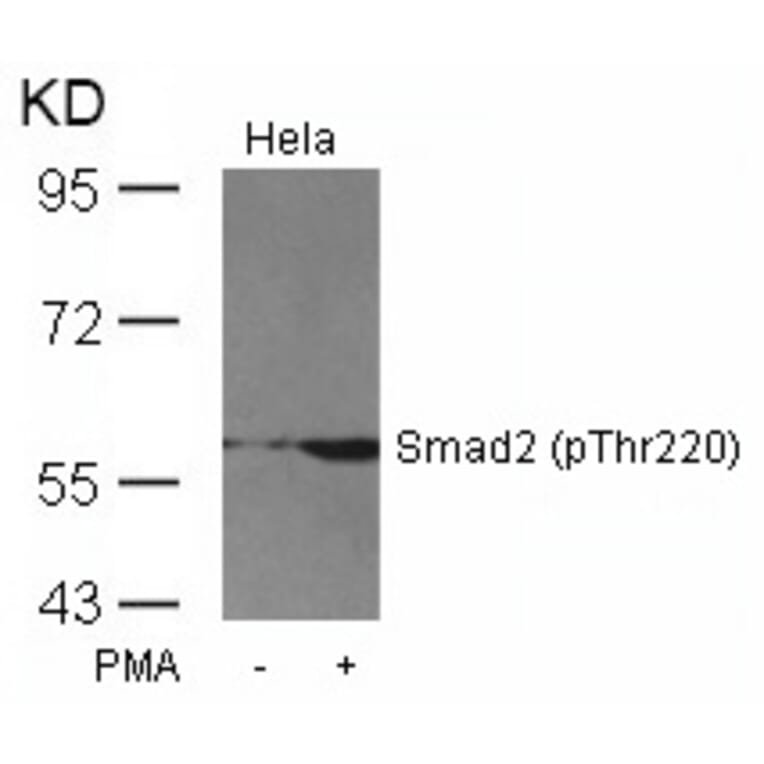 Western blot - Smad2 (Phospho-Thr220) Antibody from Signalway Antibody (11323) - Antibodies.com