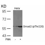 Western blot - Smad2 (Phospho-Thr220) Antibody from Signalway Antibody (11323) - Antibodies.com