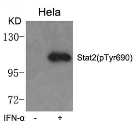 Western blot - STAT2 (phospho-Tyr690) Antibody from Signalway Antibody (11536) - Antibodies.com
