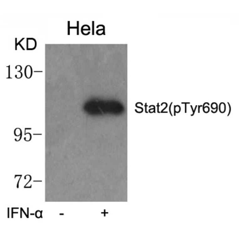 Western blot - STAT2 (phospho-Tyr690) Antibody from Signalway Antibody (11536) - Antibodies.com