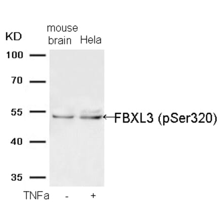 Western blot - FBXL3 (Phospho-Ser320) Antibody from Signalway Antibody (11593) - Antibodies.com