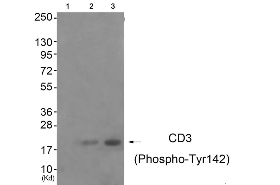 Western blot - CD3 ζ (Phospho-Tyr142) Antibody from Signalway Antibody (11655) - Antibodies.com
