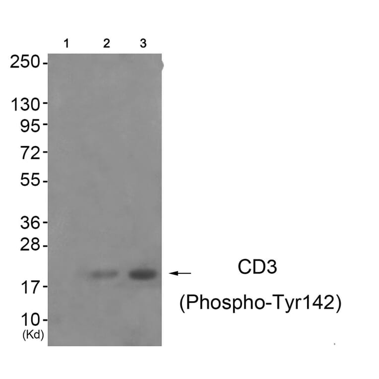 Western blot - CD3 ζ (Phospho-Tyr142) Antibody from Signalway Antibody (11655) - Antibodies.com