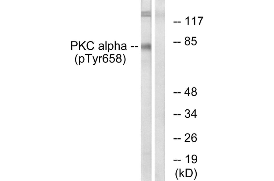 Western blot - PKC α (Phospho-Tyr658) Antibody from Signalway Antibody (11684) - Antibodies.com