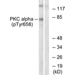 Western blot - PKC α (Phospho-Tyr658) Antibody from Signalway Antibody (11684) - Antibodies.com