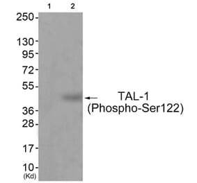 Western blot - TAL-1 (Phospho-Ser122) Antibody from Signalway Antibody (11814) - Antibodies.com