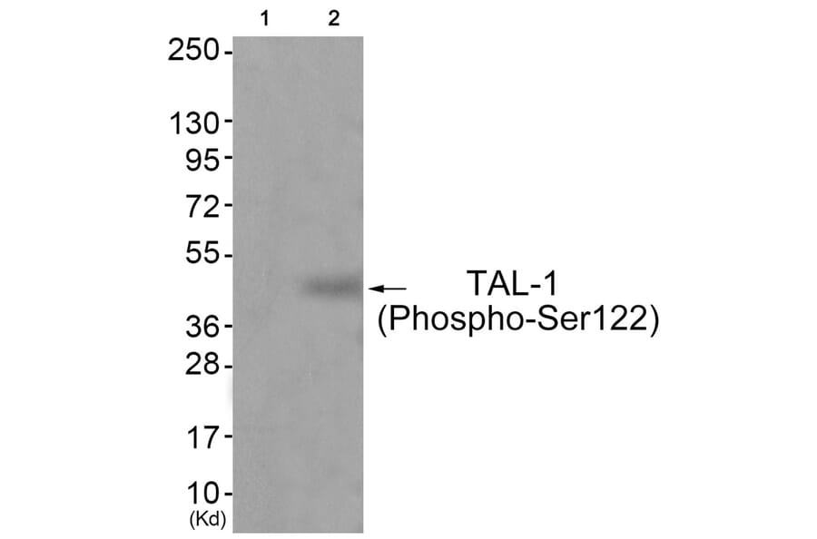 Western blot - TAL-1 (Phospho-Ser122) Antibody from Signalway Antibody (11814) - Antibodies.com