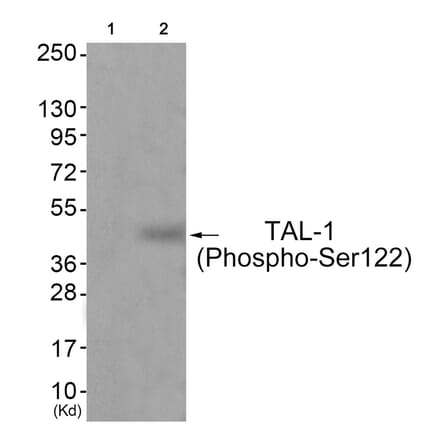 Western blot - TAL-1 (Phospho-Ser122) Antibody from Signalway Antibody (11814) - Antibodies.com