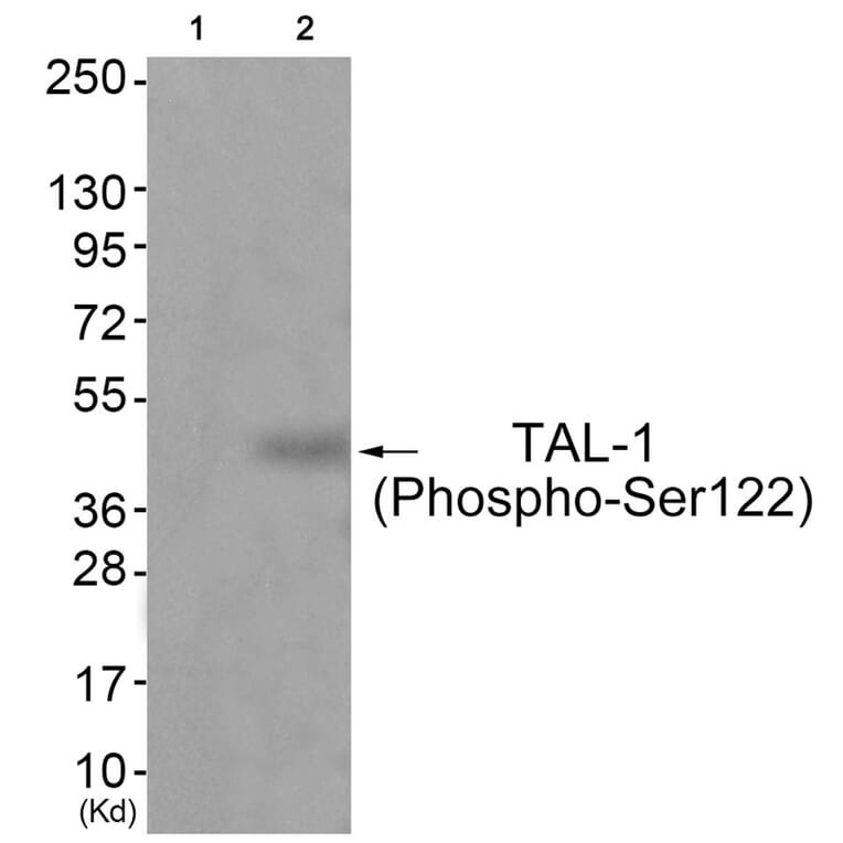 Western blot - TAL-1 (Phospho-Ser122) Antibody from Signalway Antibody (11814) - Antibodies.com