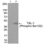 Western blot - TAL-1 (Phospho-Ser122) Antibody from Signalway Antibody (11814) - Antibodies.com