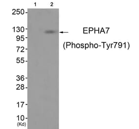Western blot - EPHA7 (Phospho-Tyr791) Antibody from Signalway Antibody (11835) - Antibodies.com