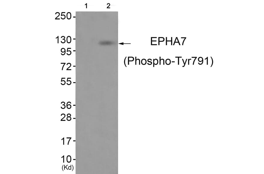 Western blot - EPHA7 (Phospho-Tyr791) Antibody from Signalway Antibody (11835) - Antibodies.com