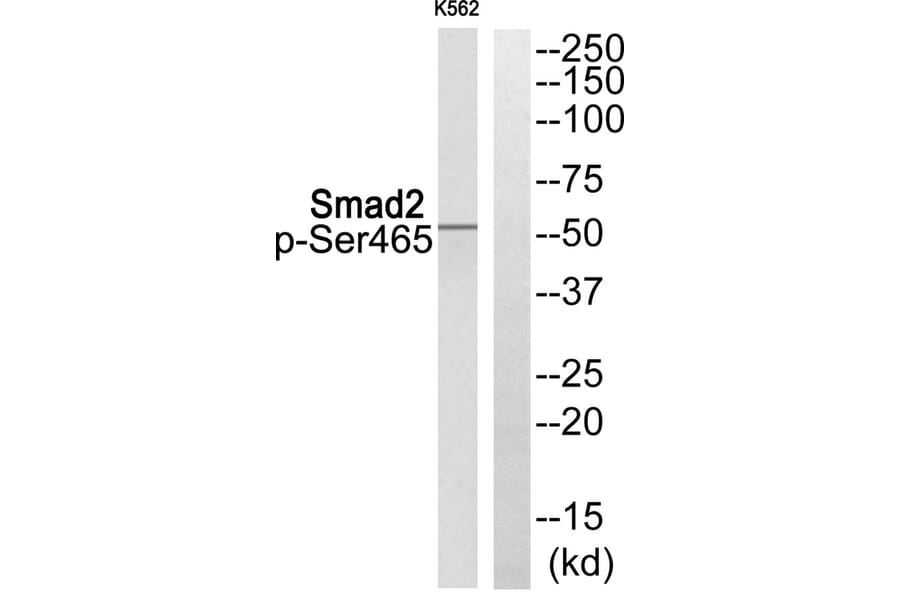 Western blot - Smad2 (Phospho-Ser465) Antibody from Signalway Antibody (11838) - Antibodies.com