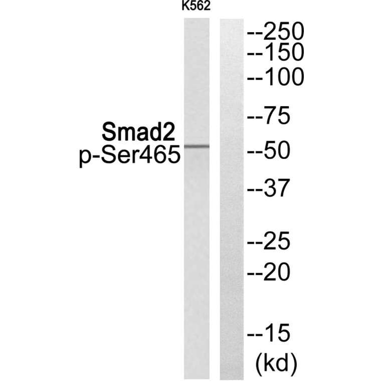 Western blot - Smad2 (Phospho-Ser465) Antibody from Signalway Antibody (11838) - Antibodies.com