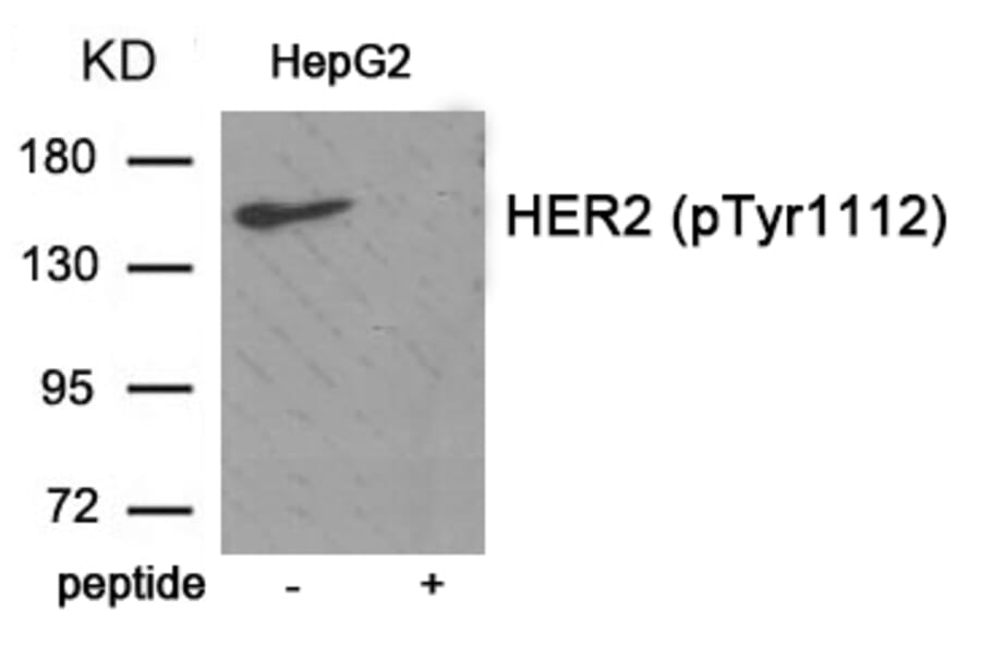 Western blot - HER2 (Phospho-Tyr1112) Antibody from Signalway Antibody (11903) - Antibodies.com