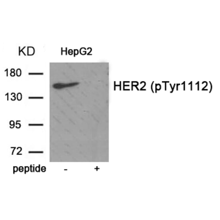 Western blot - HER2 (Phospho-Tyr1112) Antibody from Signalway Antibody (11903) - Antibodies.com