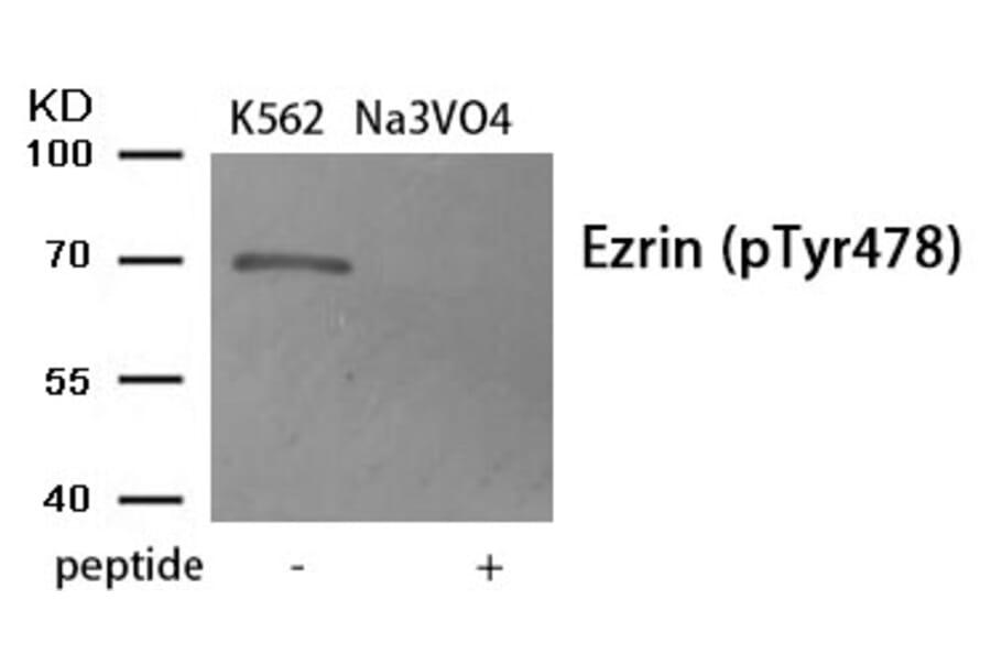 Western blot - Ezrin (Phospho-Tyr478) Antibody from Signalway Antibody (11908) - Antibodies.com