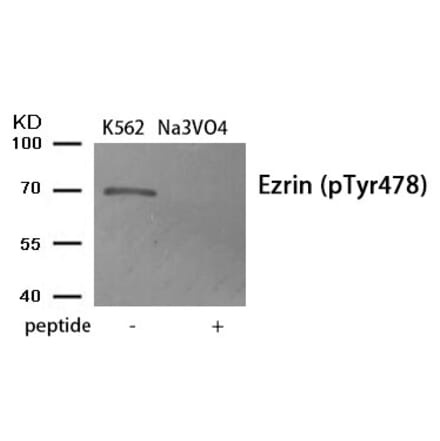 Western blot - Ezrin (Phospho-Tyr478) Antibody from Signalway Antibody (11908) - Antibodies.com