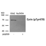 Western blot - Ezrin (Phospho-Tyr478) Antibody from Signalway Antibody (11908) - Antibodies.com