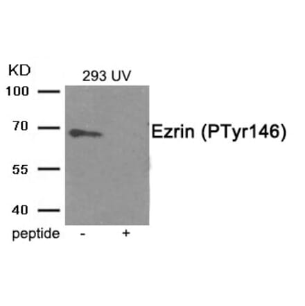 Western blot - Ezrin (Phospho-Tyr146) Antibody from Signalway Antibody (11909) - Antibodies.com