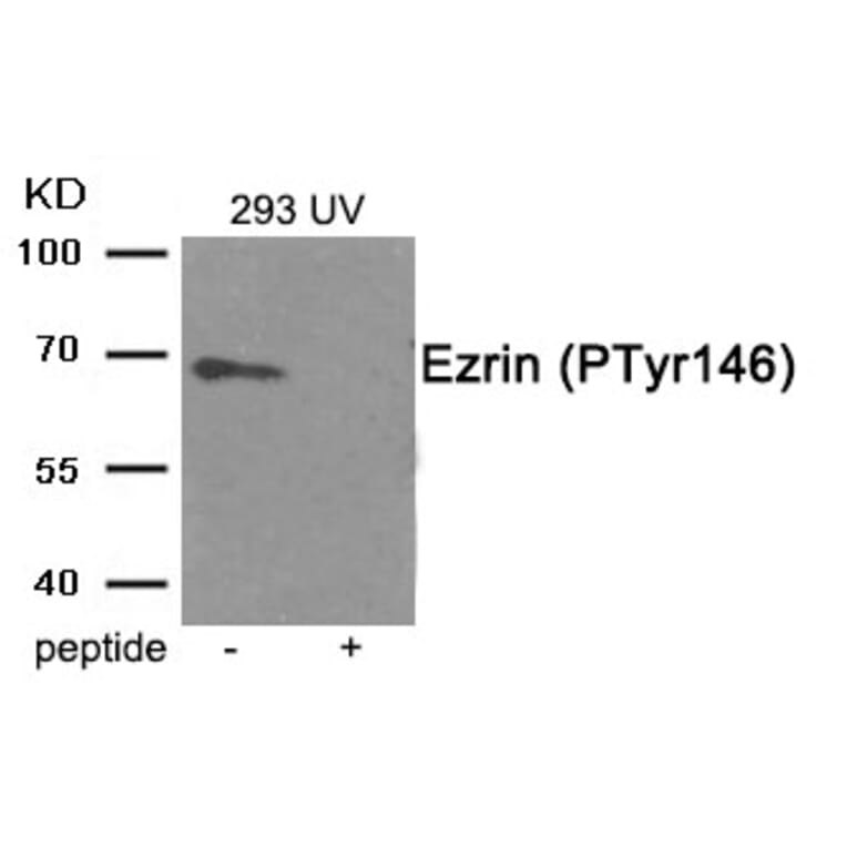 Western blot - Ezrin (Phospho-Tyr146) Antibody from Signalway Antibody (11909) - Antibodies.com