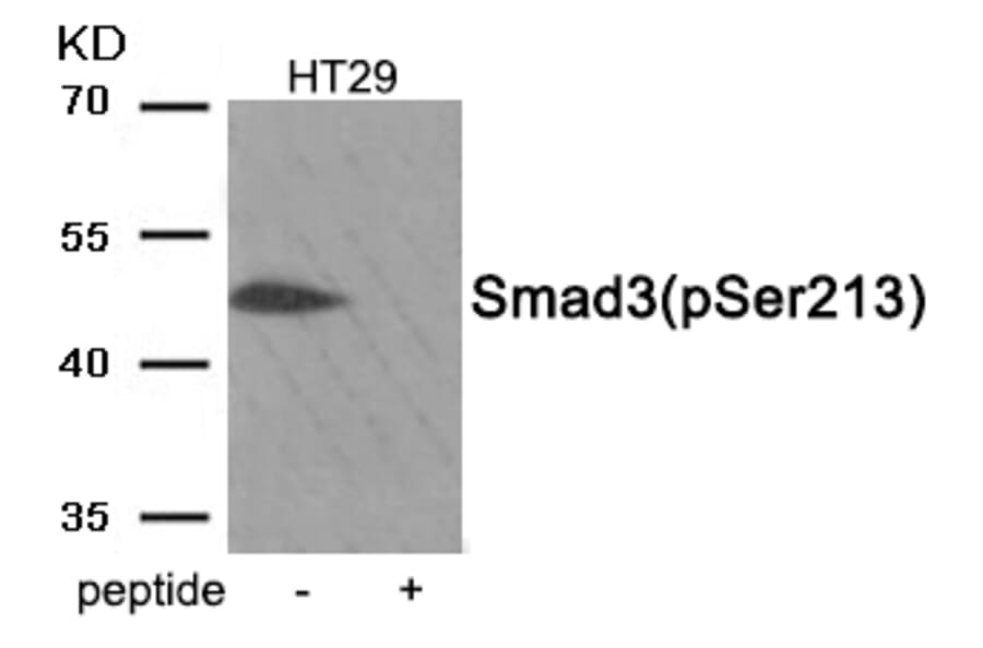 Western blot - Smad3 (Phospho-Ser213) Antibody from Signalway Antibody (11917) - Antibodies.com