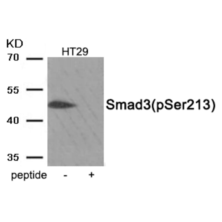Western blot - Smad3 (Phospho-Ser213) Antibody from Signalway Antibody (11917) - Antibodies.com