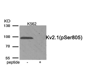 Western blot - Kv2.1 (Phospho-Ser805) Antibody from Signalway Antibody (11923) - Antibodies.com