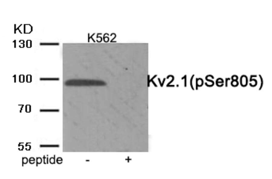 Western blot - Kv2.1 (Phospho-Ser805) Antibody from Signalway Antibody (11923) - Antibodies.com