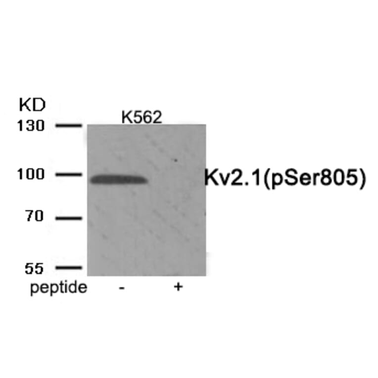 Western blot - Kv2.1 (Phospho-Ser805) Antibody from Signalway Antibody (11923) - Antibodies.com