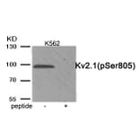 Western blot - Kv2.1 (Phospho-Ser805) Antibody from Signalway Antibody (11923) - Antibodies.com