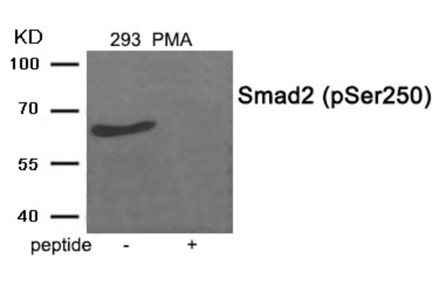 Western blot - Smad2 (Phospho-Ser250) Antibody from Signalway Antibody (11924) - Antibodies.com