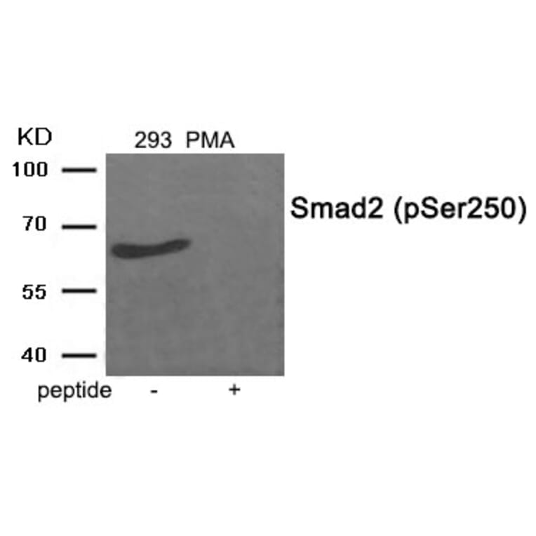 Western blot - Smad2 (Phospho-Ser250) Antibody from Signalway Antibody (11924) - Antibodies.com
