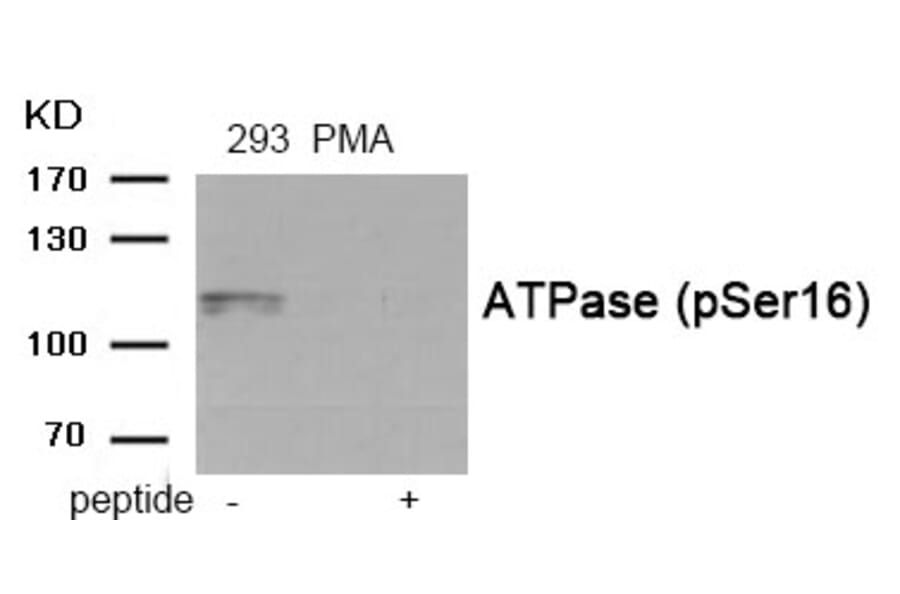 Western blot - ATPase (Phospho-Ser16) Antibody from Signalway Antibody (11938) - Antibodies.com