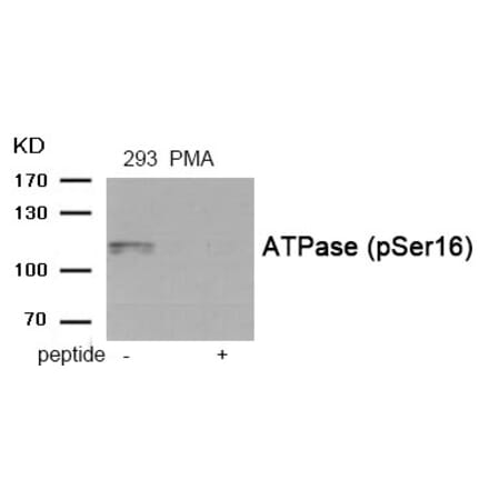 Western blot - ATPase (Phospho-Ser16) Antibody from Signalway Antibody (11938) - Antibodies.com